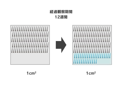 日本で販売されている育毛剤の中でもトップクラスの育毛効果があると証明